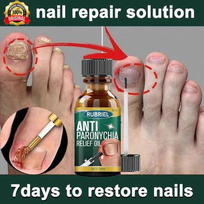 Anti Paronychia Relief Oil:  Buy 1 Get 1 Free!