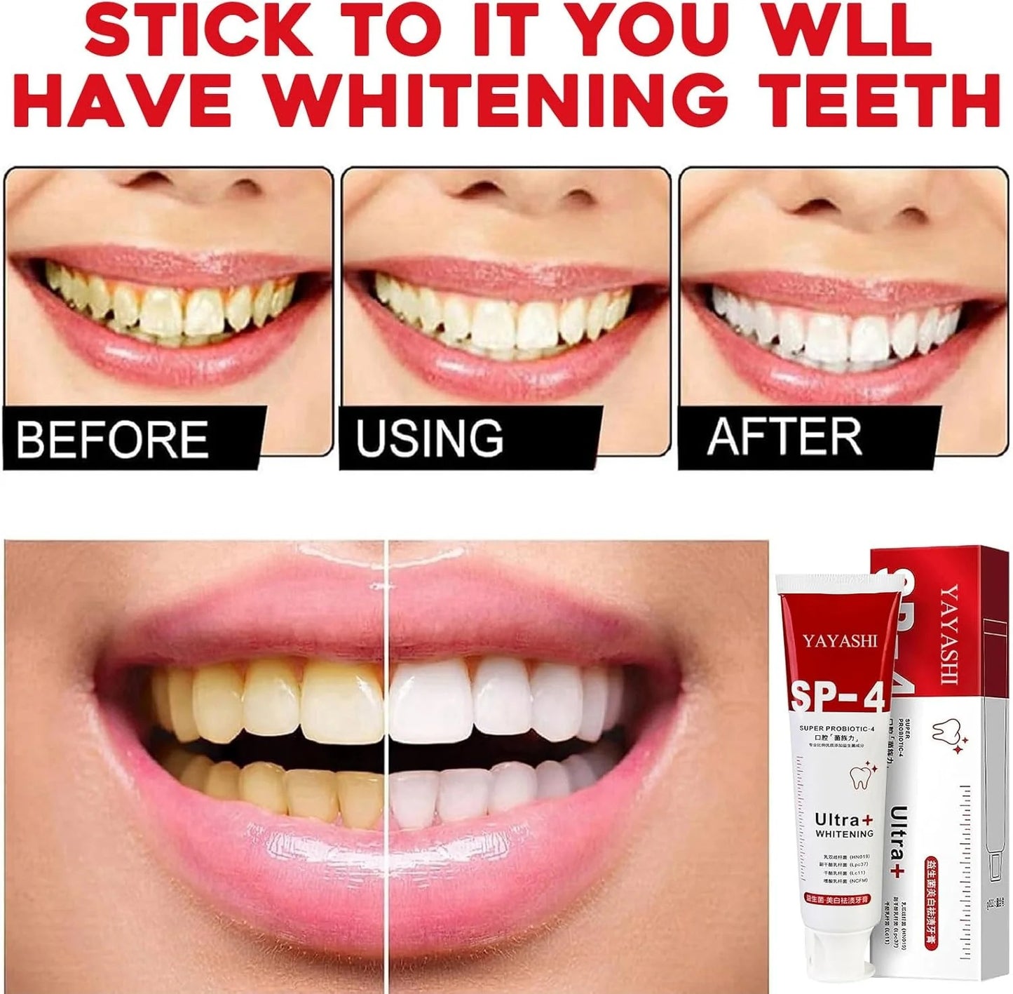 Probiotic Ultra Whitening Toothpaste : Buy 1 Get 1 Free